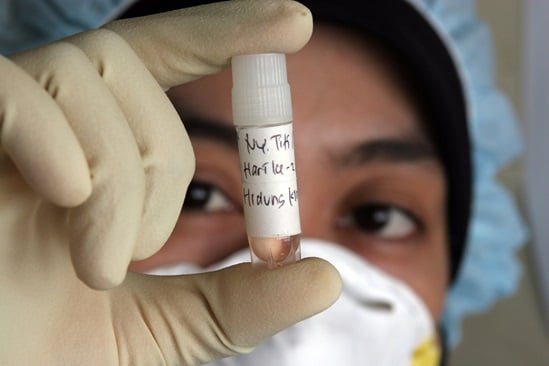 Avian Influenza testing